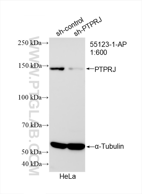 Western Blot (WB) analysis of HeLa cells using PTPRJ Polyclonal antibody (55123-1-AP)