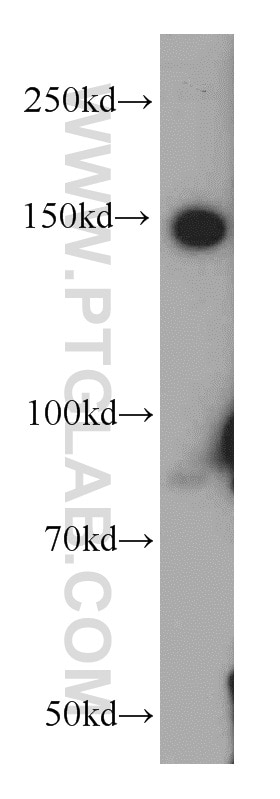 Western Blot (WB) analysis of K-562 cells using PTPRJ Polyclonal antibody (55123-1-AP)