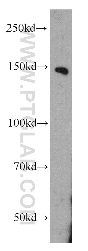Western Blot (WB) analysis of Jurkat cells using PTPRJ Polyclonal antibody (55123-1-AP)