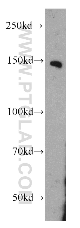 Western Blot (WB) analysis of Jurkat cells using PTPRJ Polyclonal antibody (55123-1-AP)