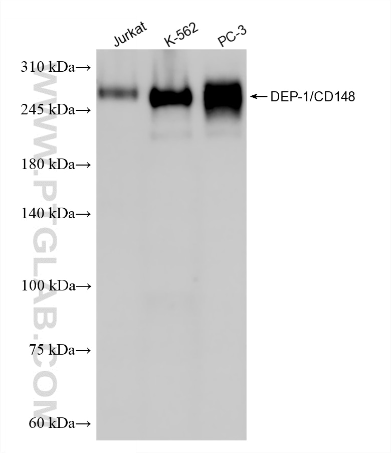 WB analysis using 87321-1-RR Western Blot (WB) analysis of various lysates using PTPRJ Recombinant monoclonal antibody (87321-1-RR)