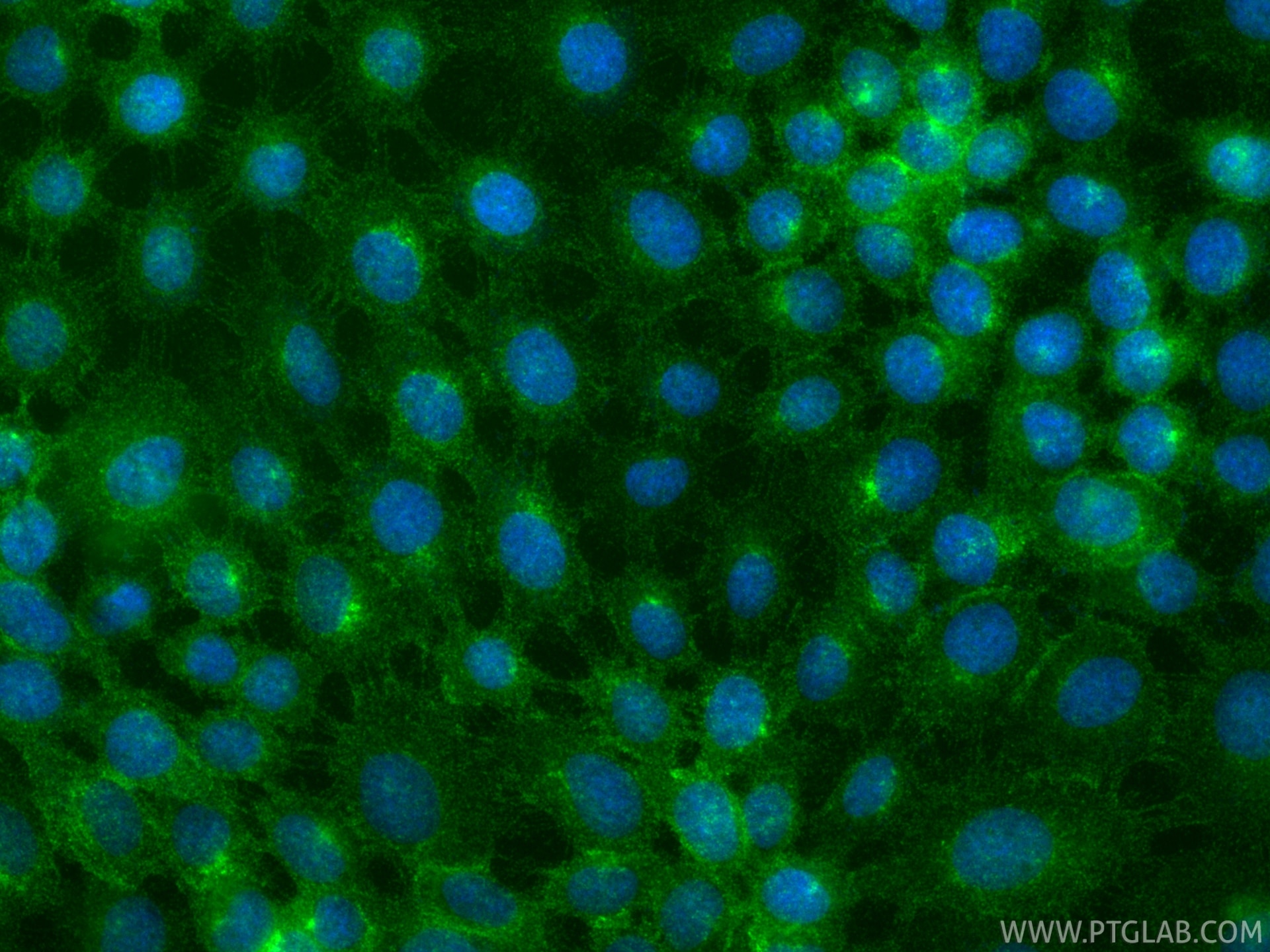 IF Staining of A431 using 98715-1-RR Immunofluorescence (IF) / fluorescent staining of A431 cells using Anti-Human PTPRJ/CD148 Rabbit Recombinant Antibody (98715-1-RR)