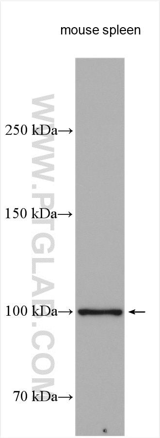 Western Blot (WB) analysis of various lysates using PTPRK Polyclonal antibody (28151-1-AP)