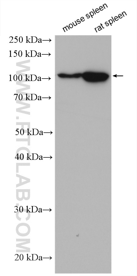 Western Blot (WB) analysis of various lysates using PTPRK Polyclonal antibody (28151-1-AP)