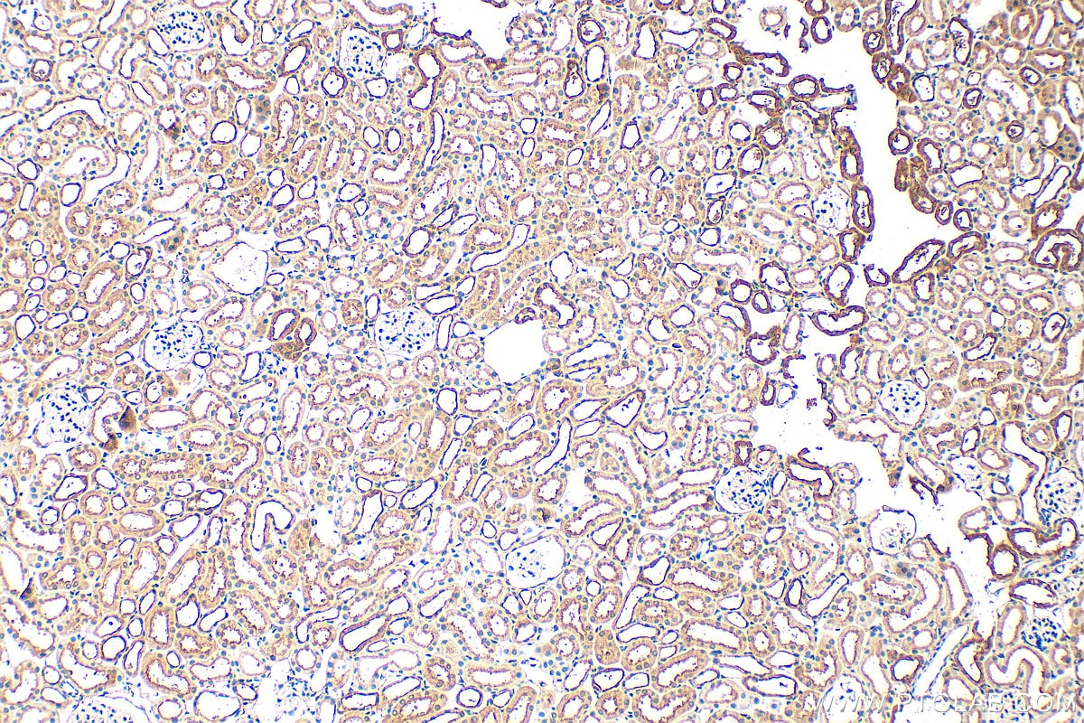 Immunohistochemistry (IHC) staining of mouse kidney tissue using PTPRM/RPTPmu Polyclonal antibody (30763-1-AP)