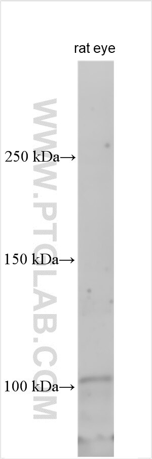 Western Blot (WB) analysis of various lysates using PTPRM/RPTPmu Polyclonal antibody (30763-1-AP)