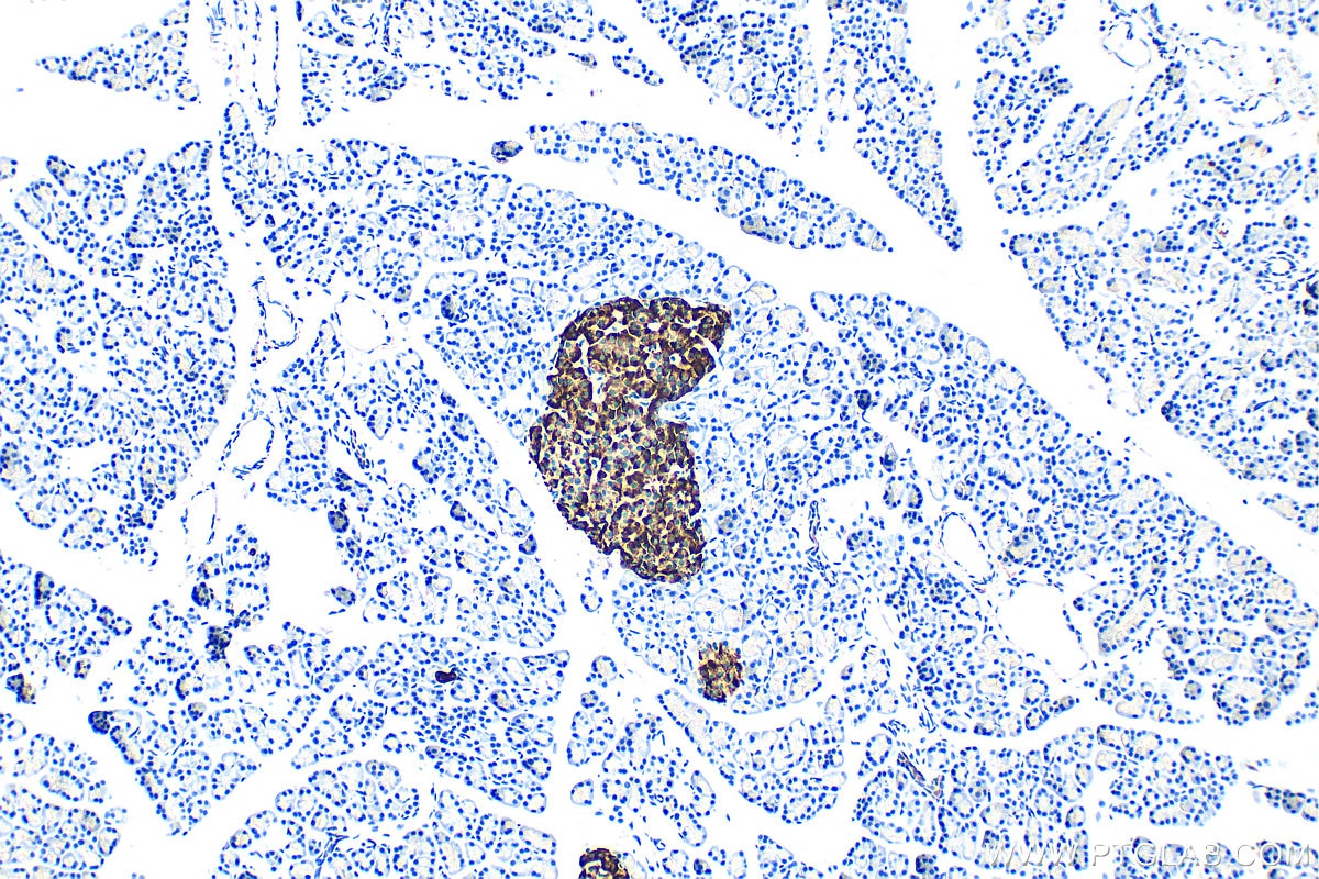 Immunohistochemistry (IHC) staining of rat pancreas tissue using IA-2/PTPRN Polyclonal antibody (10584-1-AP)
