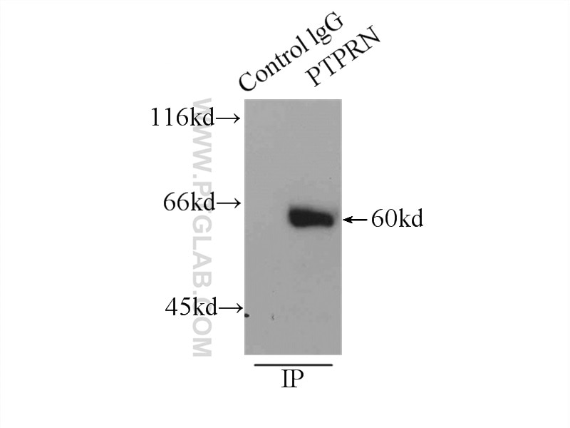 Immunoprecipitation (IP) experiment of mouse brain tissue using IA-2/PTPRN Polyclonal antibody (10584-1-AP)