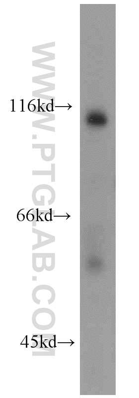 Western Blot (WB) analysis of mouse kidney tissue using IA-2/PTPRN Polyclonal antibody (10584-1-AP)