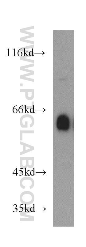 Western Blot (WB) analysis of mouse brain tissue using IA-2/PTPRN Polyclonal antibody (10584-1-AP)