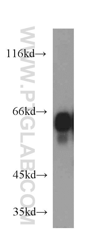 Western Blot (WB) analysis of mouse brain tissue using IA-2/PTPRN Polyclonal antibody (10584-1-AP)