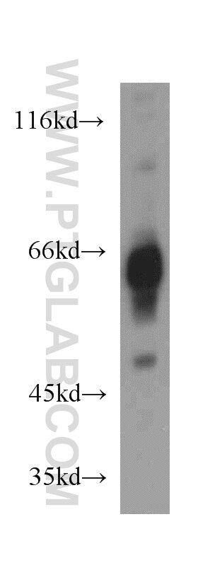 Western Blot (WB) analysis of mouse brain tissue using IA-2/PTPRN Polyclonal antibody (10584-1-AP)