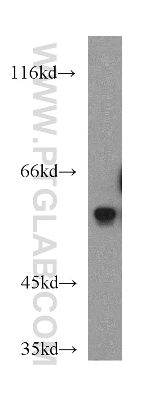 Western Blot (WB) analysis of HEK-293 cells using IA-2/PTPRN Polyclonal antibody (10584-1-AP)