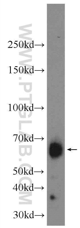 Western Blot (WB) analysis of rat brain tissue using IA-2/PTPRN Polyclonal antibody (10584-1-AP)