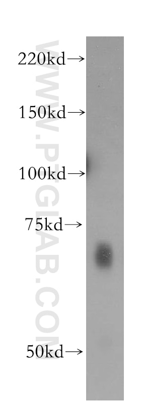 Western Blot (WB) analysis of mouse brain tissue using IA-2/PTPRN Polyclonal antibody (10584-1-AP)