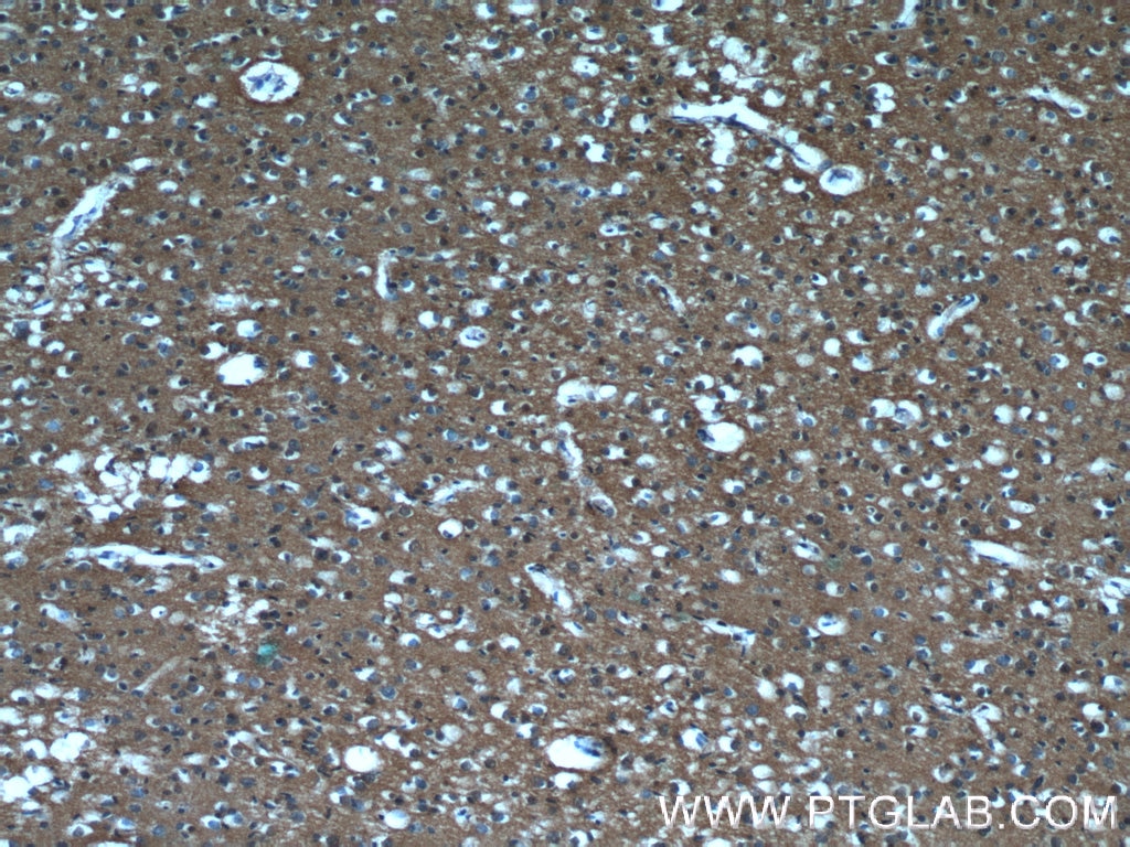 IHC staining of human brain using 66045-1-Ig