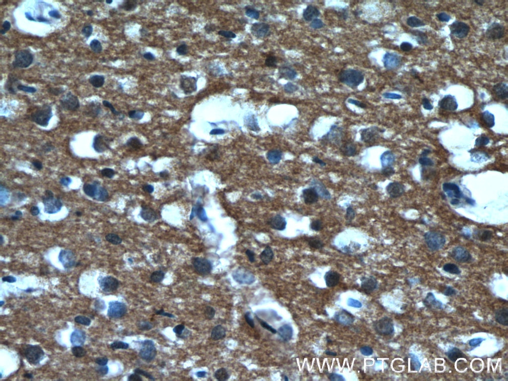 IHC staining of human brain using 66045-1-Ig