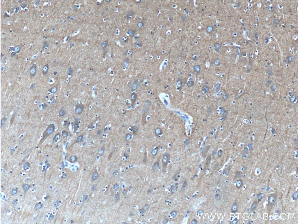 Immunohistochemistry (IHC) staining of human brain tissue using IA-2/PTPRN Monoclonal antibody (66045-1-Ig)