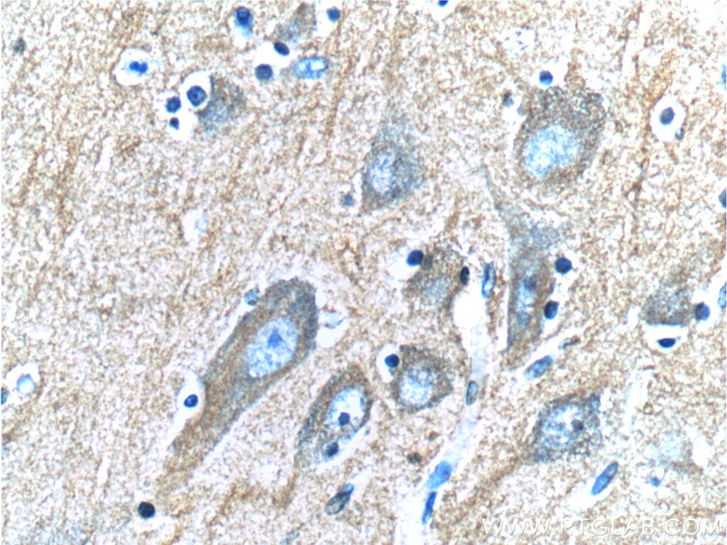 Immunohistochemistry (IHC) staining of human brain tissue using IA-2/PTPRN Monoclonal antibody (66045-1-Ig)