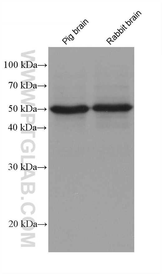 Western Blot (WB) analysis of various lysates using IA-2/PTPRN Monoclonal antibody (66045-1-Ig)