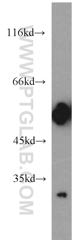 Western Blot (WB) analysis of human brain tissue using IA-2/PTPRN Monoclonal antibody (66045-1-Ig)