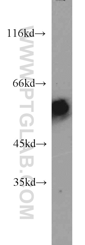 Western Blot (WB) analysis of human brain tissue using IA-2/PTPRN Monoclonal antibody (66045-1-Ig)