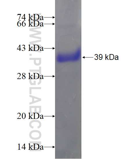 PTPRN fusion protein Ag17909 SDS-PAGE