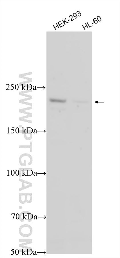 Western Blot (WB) analysis of various lysates using PTPRO Polyclonal antibody (12161-1-AP)