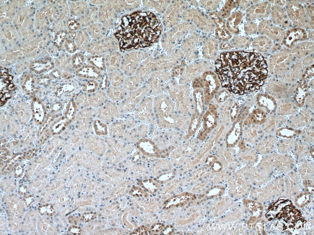 Immunohistochemistry (IHC) staining of human kidney tissue using PTPRO Monoclonal antibody (67000-1-Ig)