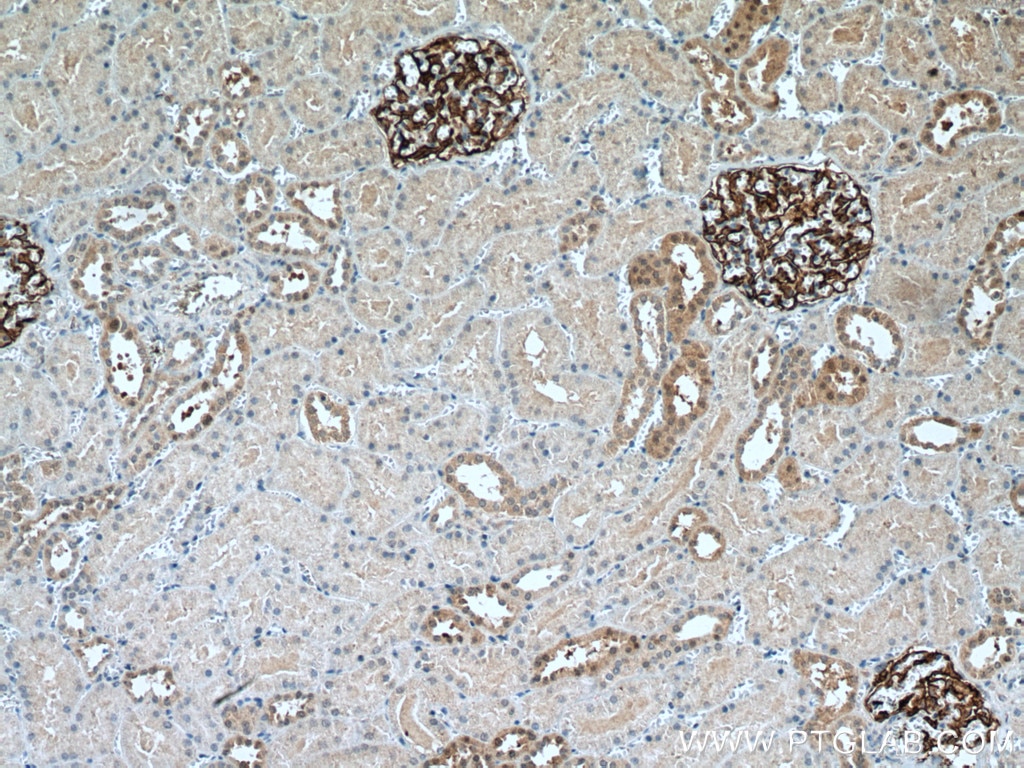 IHC staining of human kidney using 67000-1-Ig