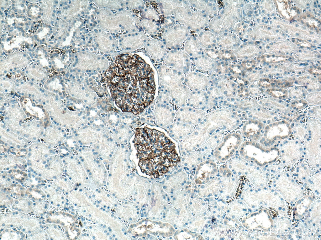 Immunohistochemistry (IHC) staining of human kidney tissue using PTPRO Monoclonal antibody (67000-1-Ig)