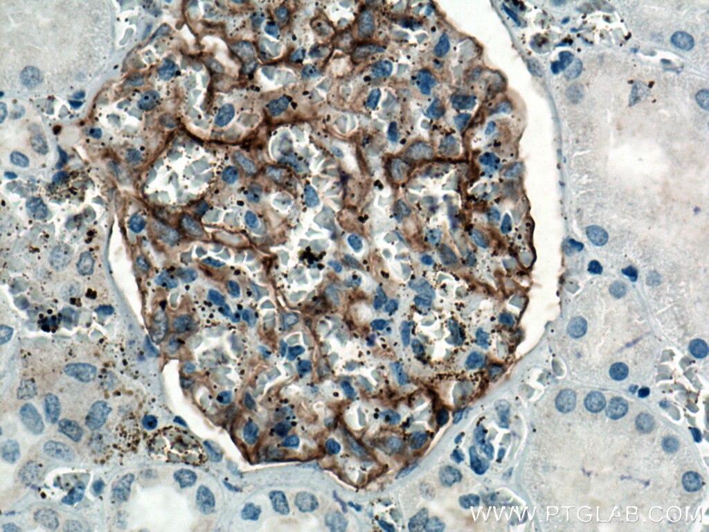 IHC staining of human kidney using 67000-1-Ig