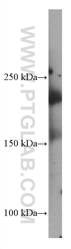 Western Blot (WB) analysis of pig kidney tissue using PTPRO Monoclonal antibody (67000-1-Ig)