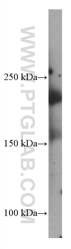 WB analysis of pig kidney using 67000-1-Ig