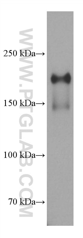 Western Blot (WB) analysis of pig kidney tissue using PTPRO Monoclonal antibody (67000-1-Ig)