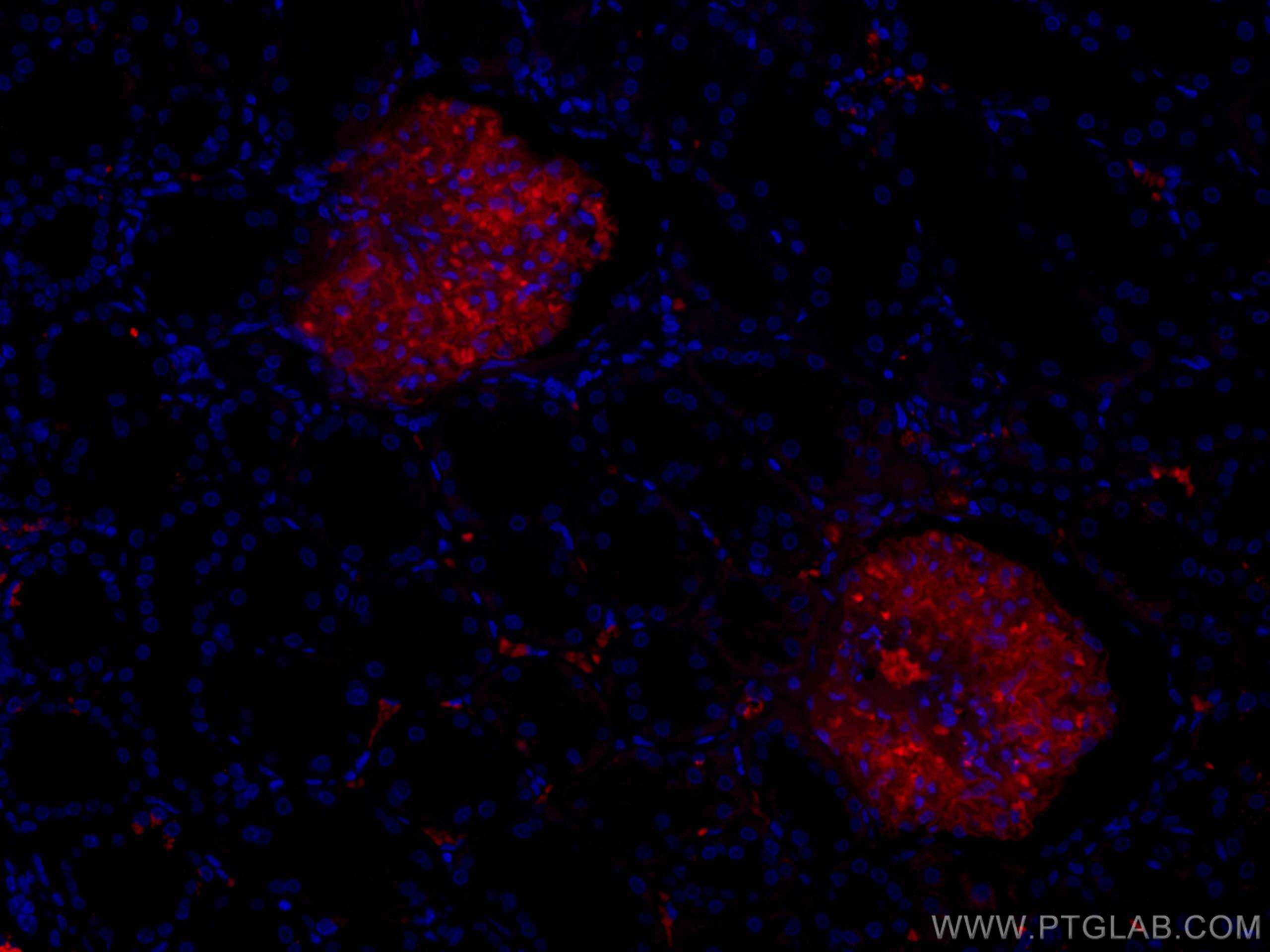Immunofluorescence (IF) / fluorescent staining of human kidney tissue using CoraLite®594-conjugated PTPRO Monoclonal antibody (CL594-67000)