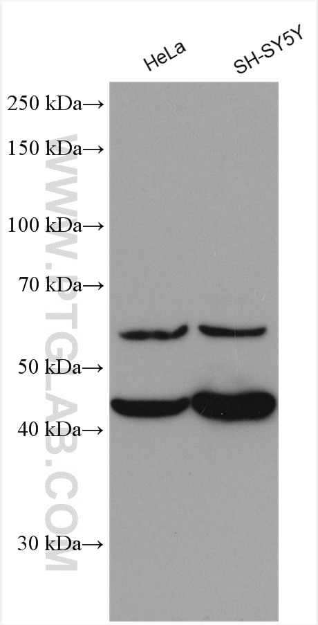 Western Blot (WB) analysis of various lysates using PTPRR Polyclonal antibody (17937-1-AP)