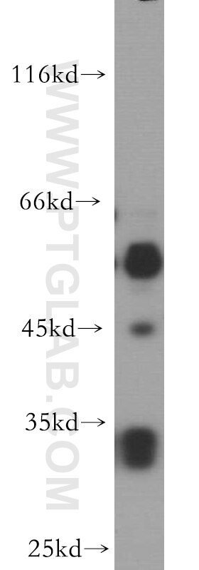 Western Blot (WB) analysis of HeLa cells using PTPRR Polyclonal antibody (17937-1-AP)