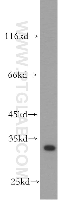 Western Blot (WB) analysis of mouse brain tissue using PTPRR Polyclonal antibody (17937-1-AP)