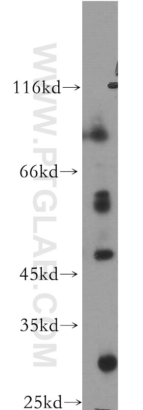 Western Blot (WB) analysis of COLO 320 cells using PTPRR Polyclonal antibody (17937-1-AP)