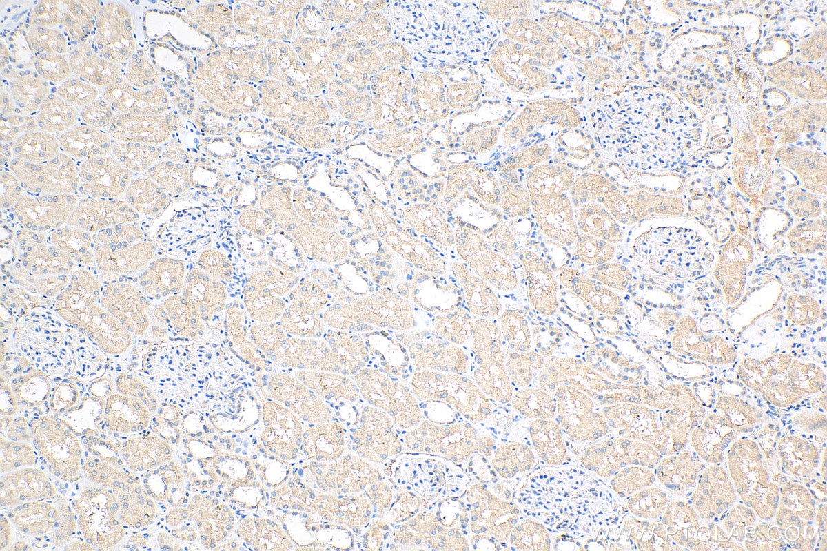Immunohistochemistry (IHC) staining of human kidney tissue using PTPRS Polyclonal antibody (13008-1-AP)