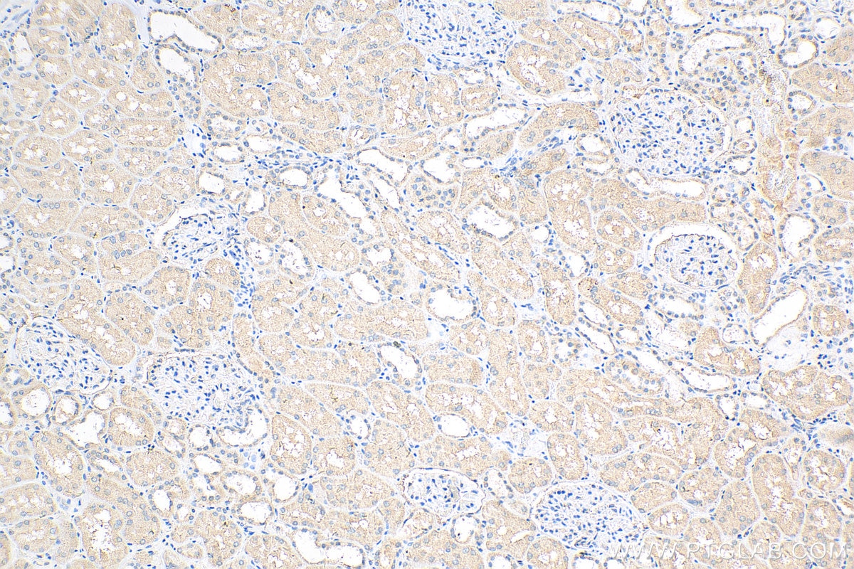 IHC staining of human kidney using 13008-1-AP