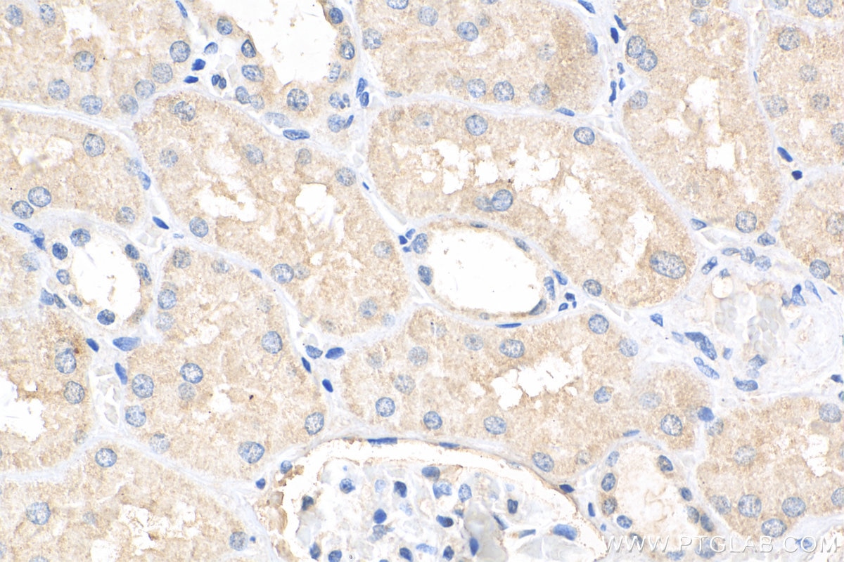 Immunohistochemistry (IHC) staining of human kidney tissue using PTPRS Polyclonal antibody (13008-1-AP)