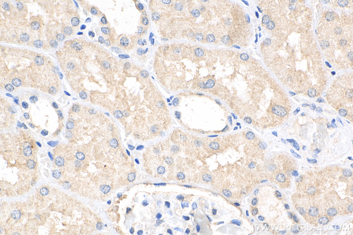 IHC staining of human kidney using 13008-1-AP