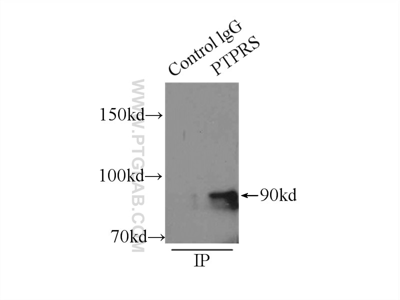 Immunoprecipitation (IP) experiment of mouse brain tissue using PTPRS Polyclonal antibody (13008-1-AP)