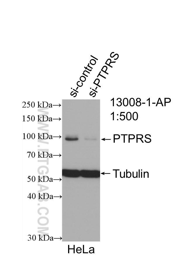 WB analysis of HeLa using 13008-1-AP