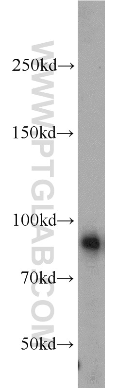 Western Blot (WB) analysis of mouse brain tissue using PTPRS Polyclonal antibody (13008-1-AP)