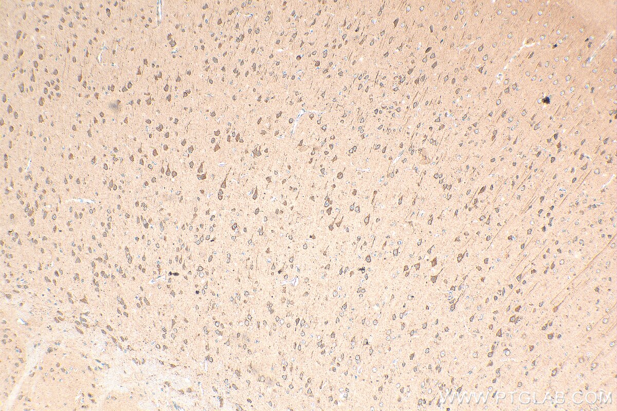 Immunohistochemistry (IHC) staining of mouse brain tissue using PTPRS Polyclonal antibody (29415-1-AP)