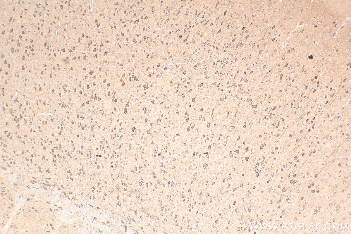 IHC staining of mouse brain using 29415-1-AP