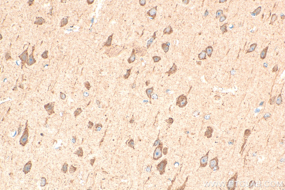 Immunohistochemistry (IHC) staining of mouse brain tissue using PTPRS Polyclonal antibody (29415-1-AP)